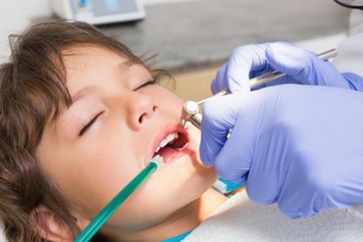 безопасное лечение детских зубов под наркозом